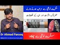 Smoking effects risks addiction quitting treatment  dr ahmad farooq