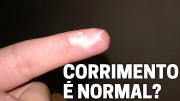 É normal ter corrimento branco o mês todo?