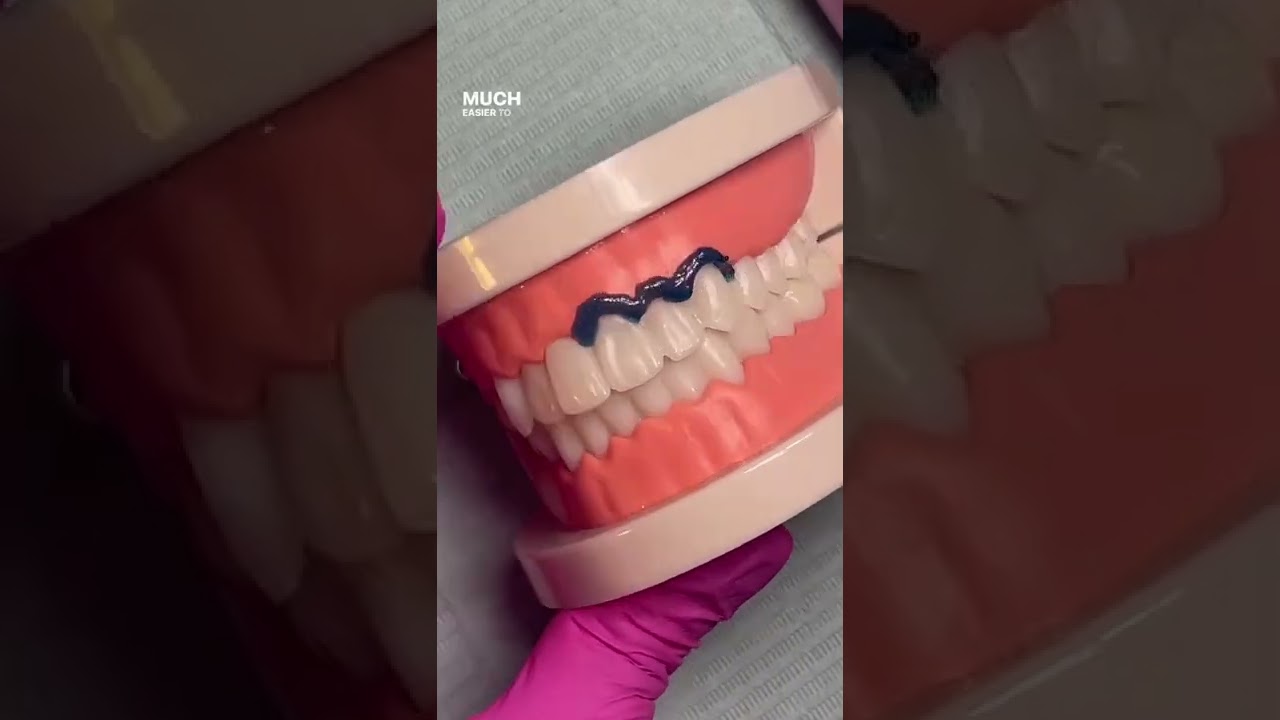 How to: Apply Gingival Barrier to Prepare for a Teeth Whitening Session