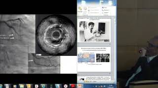П.А. Болотов, Внутрисосудистый ультразвук и оптико-когерентная томография коронарных артерий ..