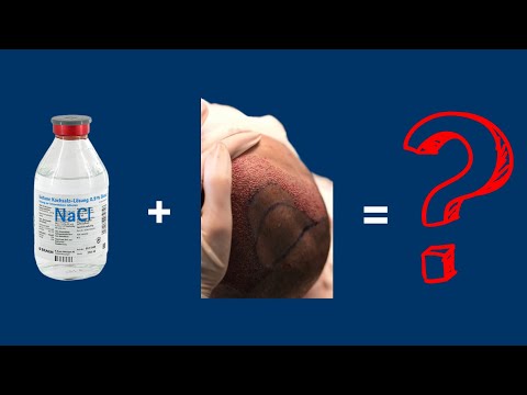 Hair Transplant and Saline Solution – the Perfect Combination?