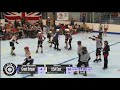 WC12 TGB V USE