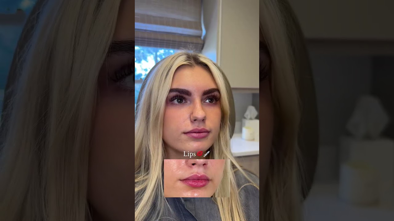 Lip artist at work💋💉