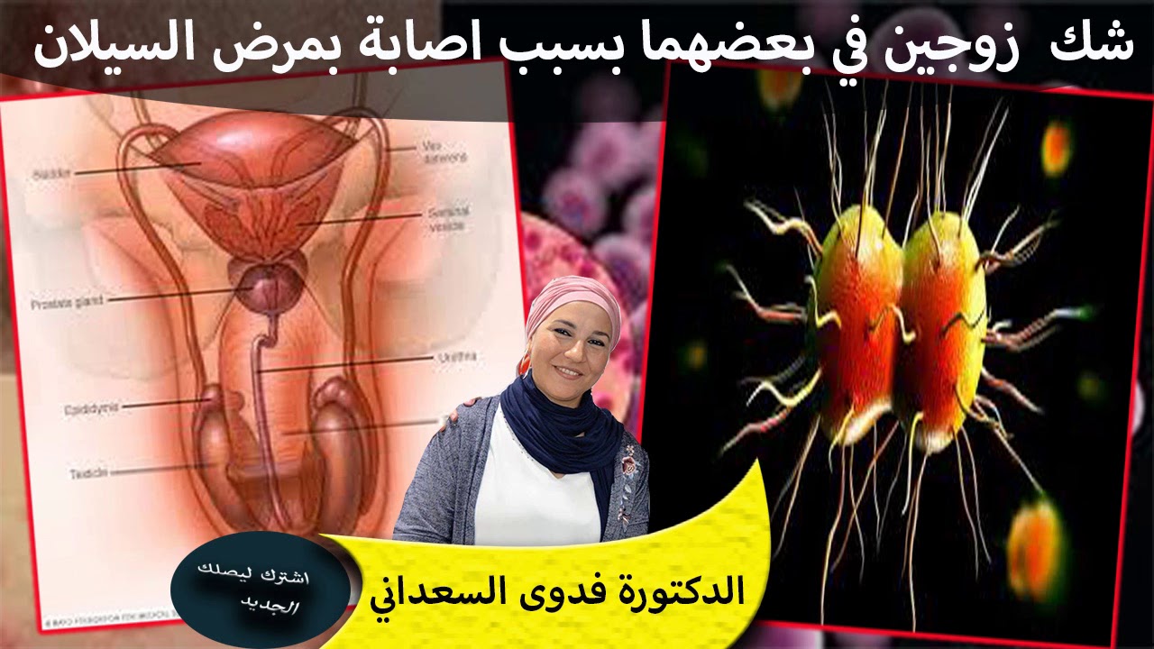 شك زوجين في بعضهما بسبب اصابة بمرض السيلان الدكتورة فدوى السعداني