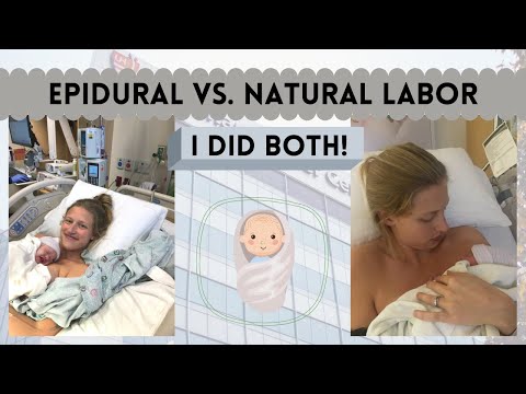 Video: Natural Birth Vs. Epidural: Hva Du Kan Forvente