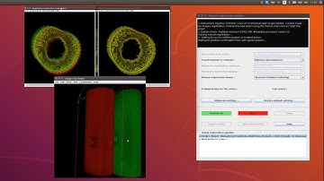 Fijiyama : 3d registration tutorial