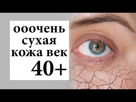 Видео: 3 способа излечить сухую кожу вокруг глаз