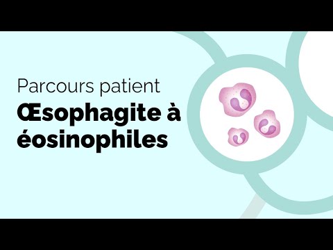 Vidéo: 4 façons simples de prévenir l'œsophagite à éosinophiles