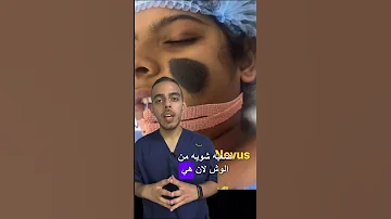 علاج الوحمه في الوجه و مخاطرها طب Shorts 