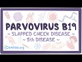 Parvovirus B19 - causes, symptoms, diagnosis, treatment, pathology