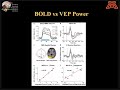 Multimodal Functional Neuroimaging: Part II