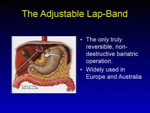 36 Gastrointestinal Hepatic Systems Raymond M Planinsic, MD