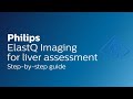 Philips Ultrasound: ElastQ Imaging for liver assessment