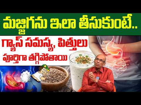 మజ్జిగ ఇలా తీసుకుంటే గ్యాస్ పూర్తిగా తగ్గిపోతుంది! | Gastric Problem | Madhusudana Sarma | iDream