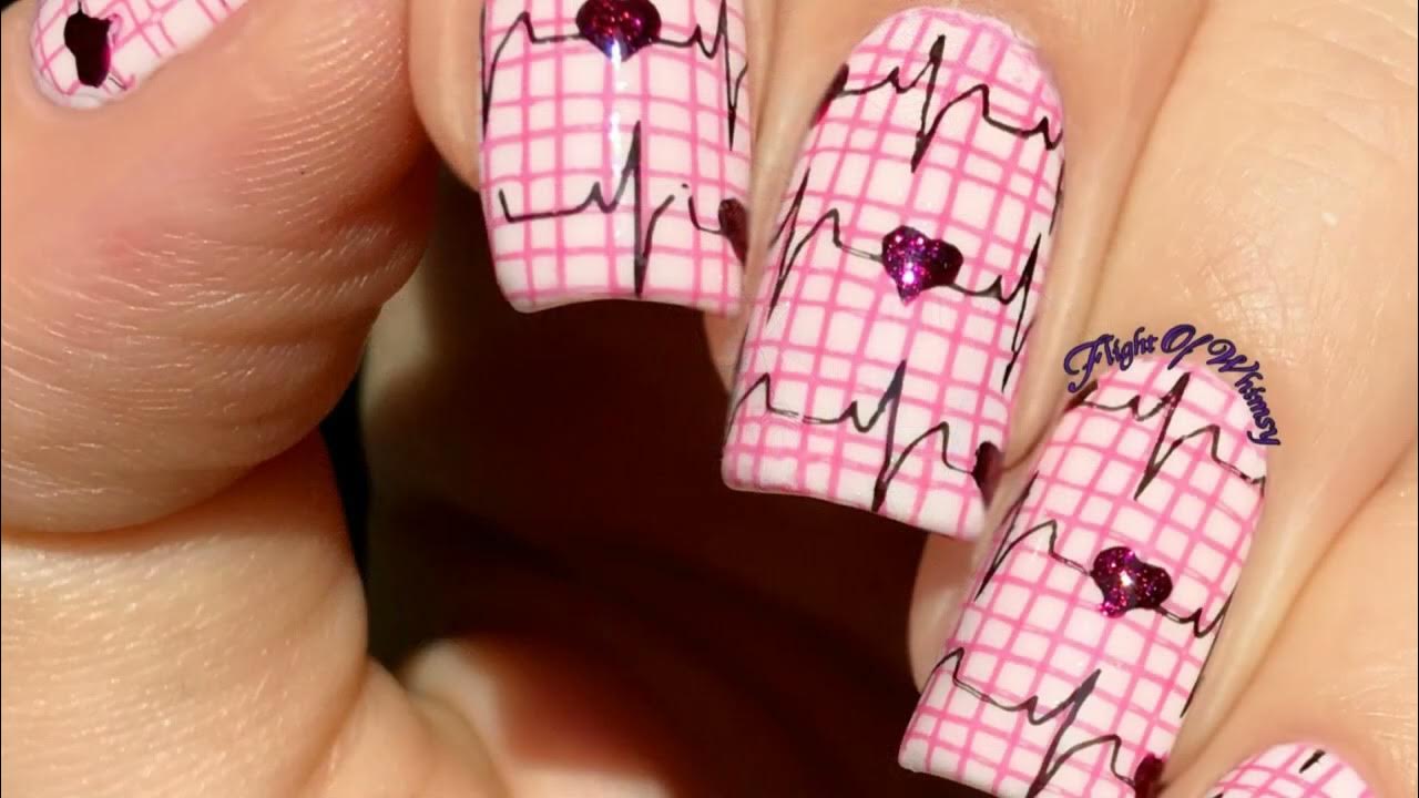 beau-s-lines-in-nails-unveiling-clues-to-a-patient-s-medical-history
