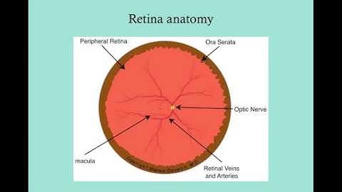 Retinopathy of Prematurity   CRASH! USMLE Step 2 and 3
