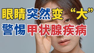 眼睛异常变化 竟是健康危机的“信号灯”？20250925 眼睛里的健康信号 | CCTV科教《健康之路》