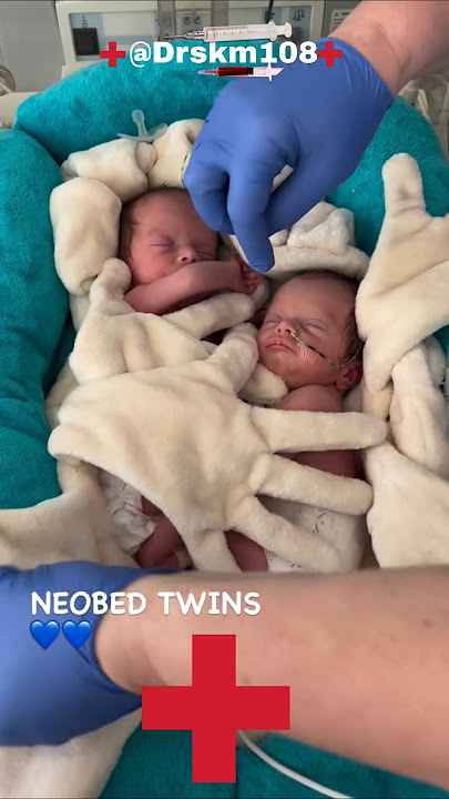 Twins baby#umbilicalcord #twins #newbornarrival#cute #born#newborn#ytshort#tiktok Drskm108