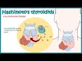 Hashimotos thyroiditis | Autoimmune diseases