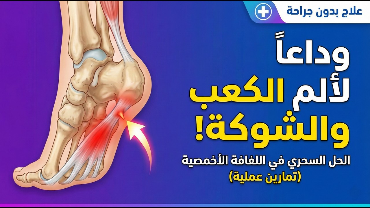 وداعاً لألم كعب القدم: الحقيقة الكاملة عن الشوكة العظمية واللفافة الأخمصية ✅
