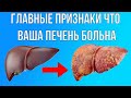 Главные признаки больной печени. 90 % людей об этом не знают !