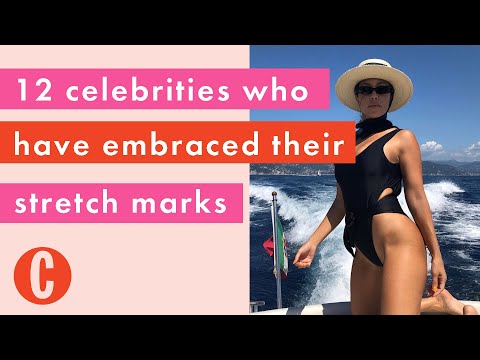 Video: Model Rocks Her Stretch Marks På Sociala Medier