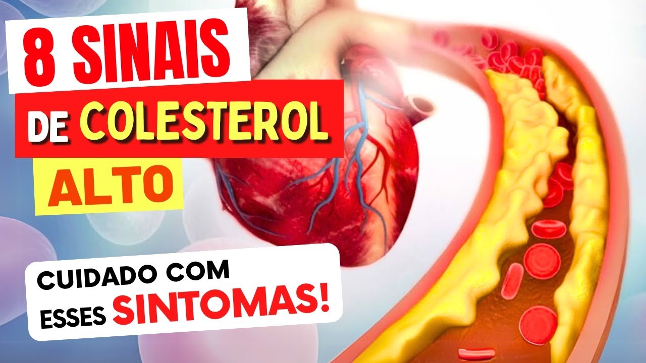 8 SINAIS de COLESTEROL ALTO - Cuidado com estes Sintomas! - YouTube