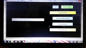 Iris Segmentation based on RCD Technique