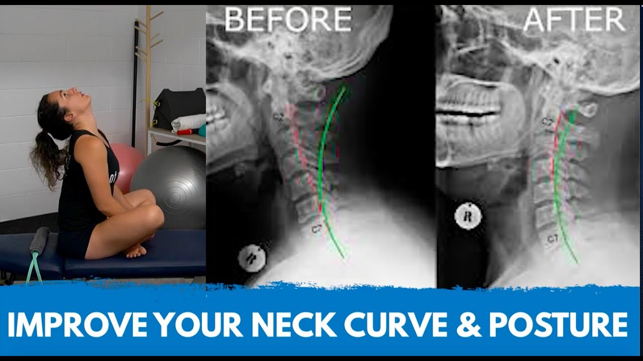 How To Get Your Neck Curve Back The Best Exercises For Neck Curve & Posture Correction - YouTube