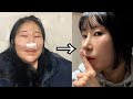 코수술 대박나서 돌아온 개그우먼 이세영 [코수술 일주일 VLOG]