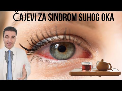 ČUDESNI ČAJEVI koji prirodno LIJEČE SINDROMA SUHOG OKA!