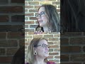 Post-Birth Headaches: The Spinal Fluid Complication #shorts