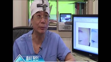 SBS 진세훈박사 자가진피재생술 방영