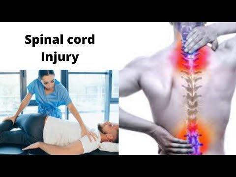 Spinal cord injury / ریڑھ کی ہڈی کی چوٹ/ rearih ki hadi pr pain/ spinal cord injury cases
