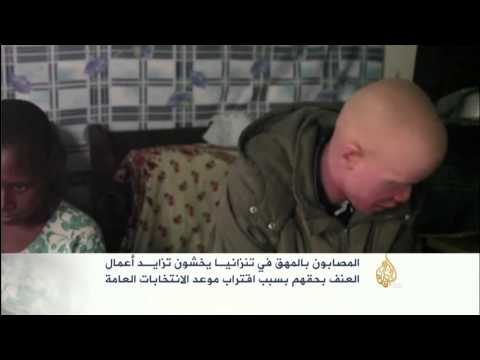 المصابون بالمهق في تنزانيا يخشون العنف بحقهم