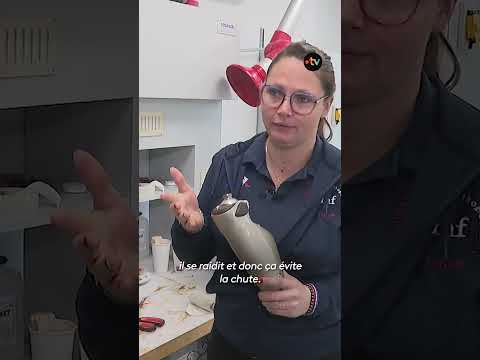 Amputée à 23 ans après un accident de la route, elle reprend le cours de sa vie grâce à sa prothèse