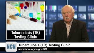 Tuberculosis TB Testing Clinic