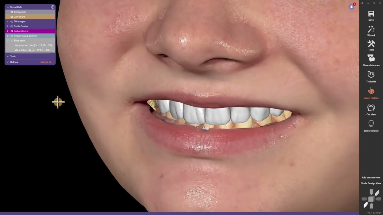 Smile trial in about 1hr? Yep - YouTube