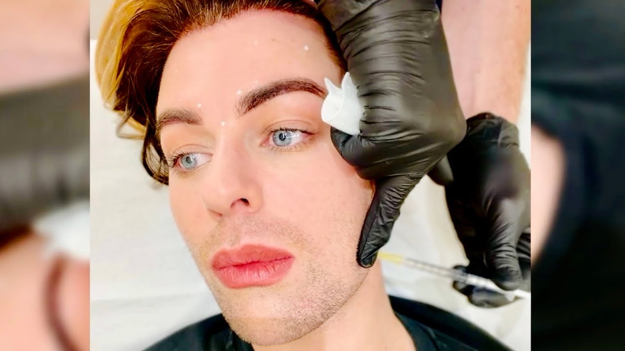 How Botox Treats TMJ & Overactive Masseter Muscles - YouTube