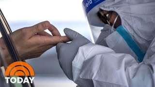 FDA Approves Coronavirus Antibody Test For Emergency Use | TODAY