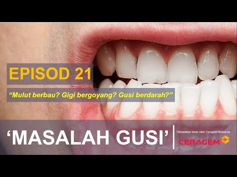 Video: Gigi Grey: Diagnosis, Punca, Rawatan, Dan Banyak Lagi