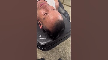 Looking great after only 2 sessions of smp #scalpmicropigmentation #hairlosstreatment #tattoo