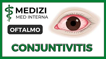 ¿Cómo saber si la conjuntivitis es bacteriana o vírica?