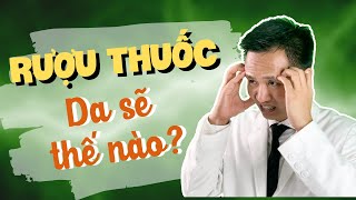 List 20+ review rượu thuốc trị mụn hay nhất