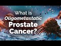 What is Oligometastatic Prostate Cancer?