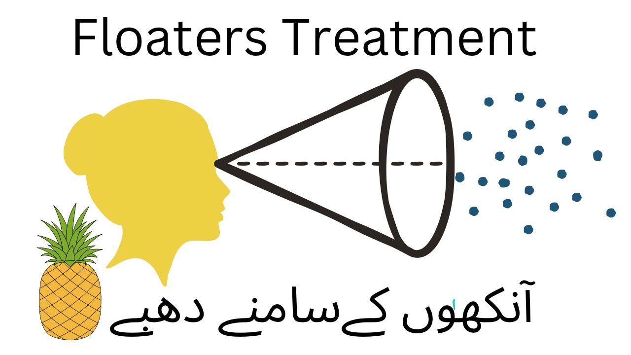 Eye Floaters And Pineapple Link آنکھ کے دھبے Dr Humaira Kay Sath