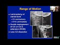 Multilevel Cervical Stenosis  Laminoplasty - Brian W. Su, MD