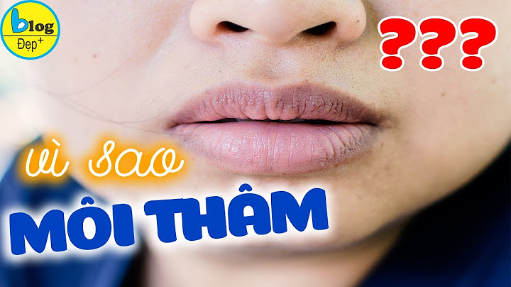 Làm thế nào để môi không bị thâm