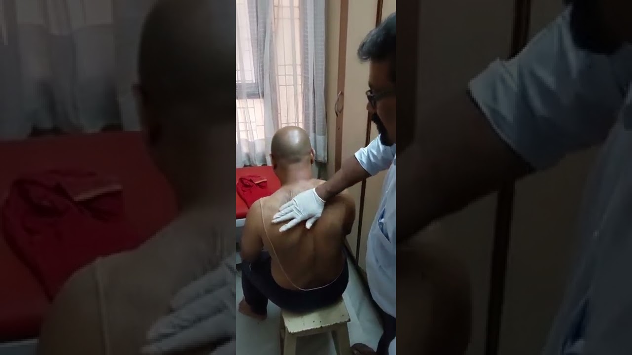 Marma chikitsha- Marma manipulation Cervical spine manipulation