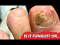 Is It Fungus? Or Something Else..